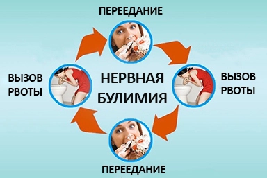 Лечение булимии в Железноводске